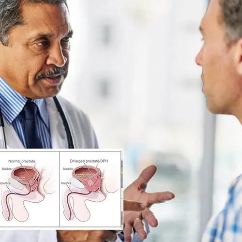 Choosing the Right Penile Implant for Your Lifestyle