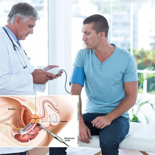 Maintaining Long-Term Success with Your Penile Implant